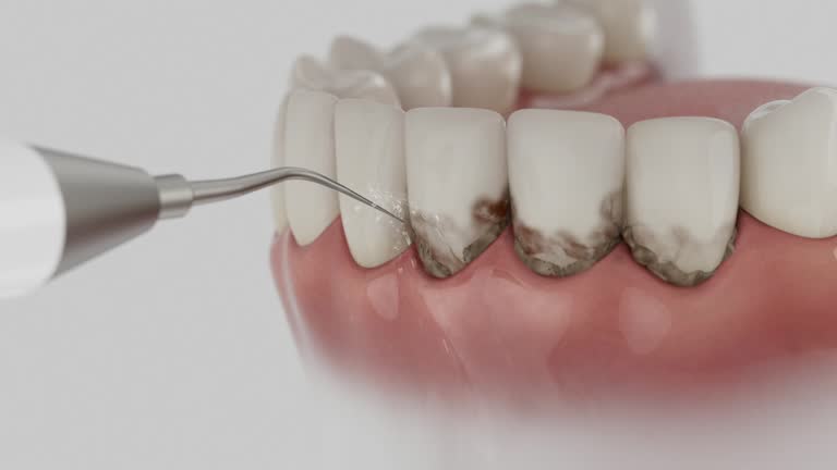 Reliable Dental contractor in Winchester, MO by Smile Center Dentistry
